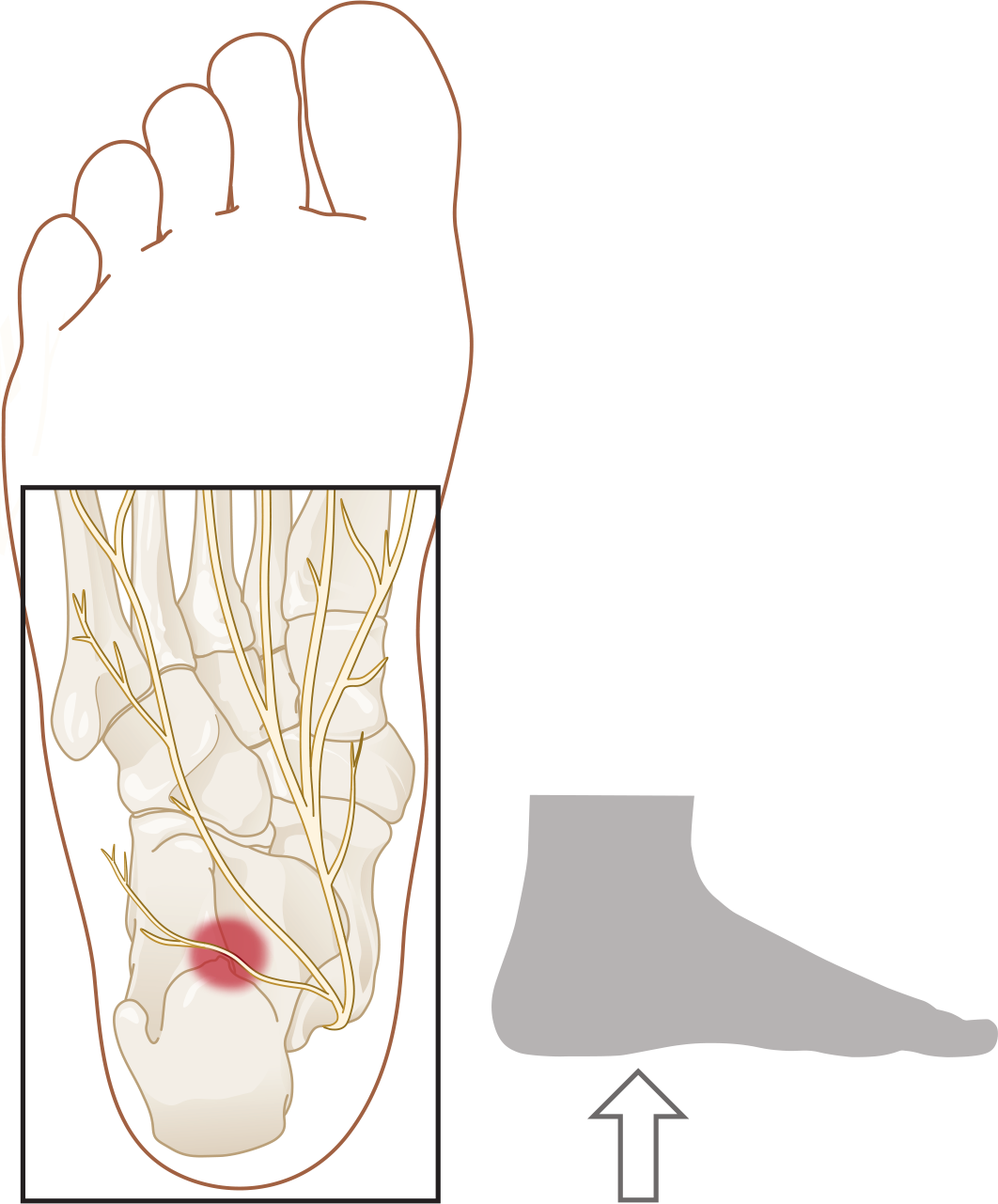 De zenuw van Baxter is een kleine zenuw onder de hiel die een spier bij de kleine teen aanstuurt.